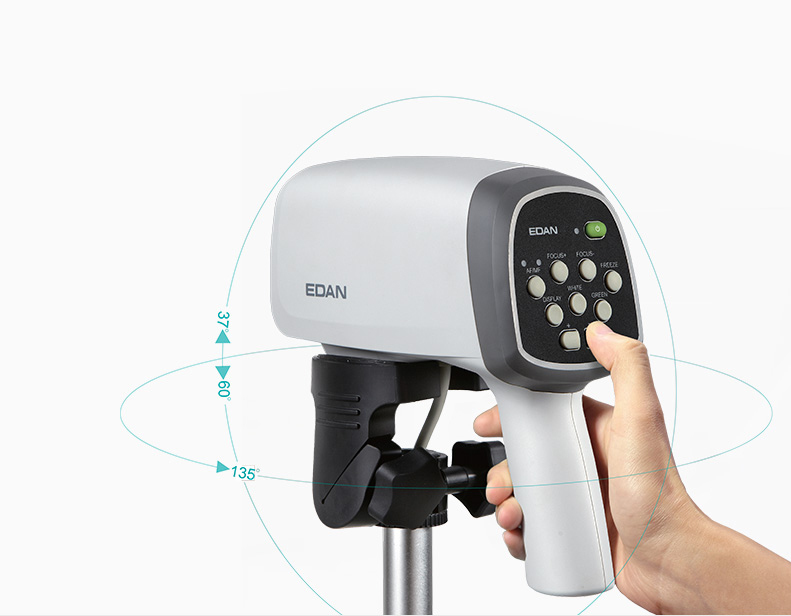Цифровой видеокольпоскоп Edan C6 HD — изображение 3